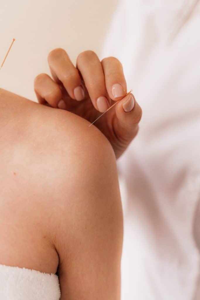 acupuncture2-683x1024.jpg